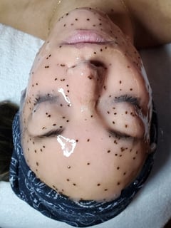 View Cosmetic, Skin Treatments, Facial - Jenna Duncan, Atlanta, GA