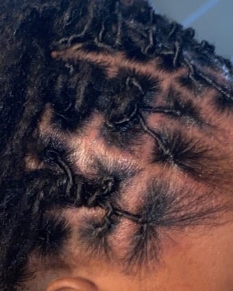 Image of  Women's Hair, Locs, Hairstyles, Natural