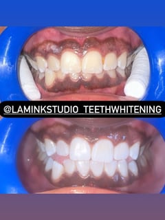 View Lashes, Classic, Eyelash Extensions, Teeth Whitening, Volume, Wet Lashes, Dentistry, Teeth Bleaching, Dentistry Services - Kayla Kay, New York, NY