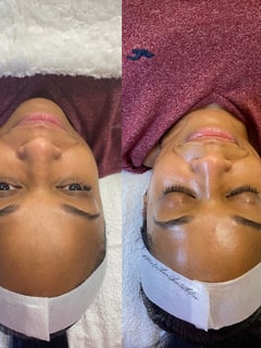 View Skin Treatments, Facial - Tay Moore, Columbus, GA