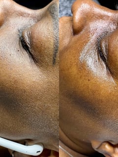 View Skin Treatments, Facial - Takiyah Rockmore, Dallas, TX