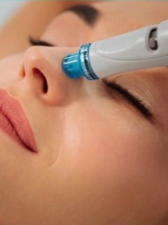 View Microneedling, Forehead, Nose, Chin, Minimally Invasive, Neck Tightening, Filler, Lips, Cheeks, Smile Lines, LED Acne Therapy, Dermaplaning, PRP Facial, HydraFacial, Upper Face, Eyes, Low-Level Laser Therapy, Lower Face, Body Sculpting, Skin Treatments, Radio Frequency, Cosmetic, Skin Treatments, Neurotoxin, Facial, Chemical Peel, Microdermabrasion - Jen Phillips-Kiernan, Round Rock, TX