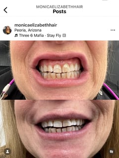 View Dentistry Services, Dentistry, Teeth Whitening - Monica Cantu, Peoria, AZ