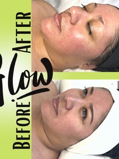 View Skin Treatments, Skin Treatments, Facial - Danielle Roper, Colorado Springs, CO