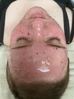 View Facial, Skin Treatments - Tatyana Fedoruk, Arlington, WA