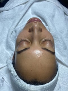 View Facial, Skin Treatments - Jennifer Wright, Dallas, TX