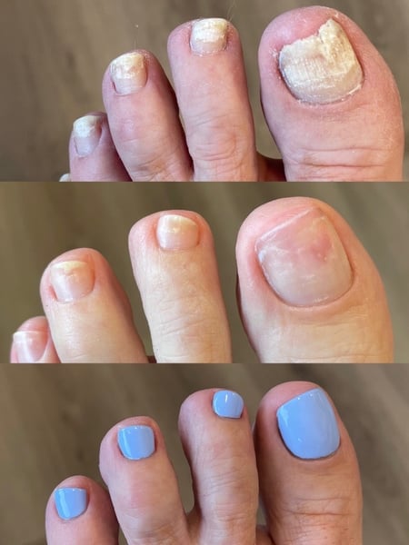 Image of  Nails, Pedicure, Blue, Nail Color