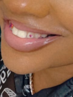 View Cosmetic, Cosmetic Dentistry, Teeth Bleaching, Teeth Whitening - Angel Brooks, Jacksonville, FL