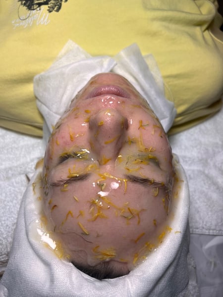 Image of  Facial, Skin Treatments, Dermaplaning