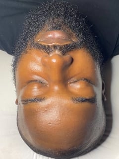 View Cosmetic, Facial, Skin Treatments - Monique Rennier , 