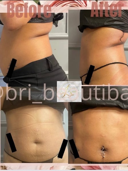Image of  Body Sculpting, Cosmetic