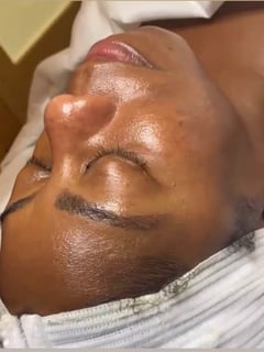 View Facial, Skin Treatments, Microdermabrasion - Jennifer Wright, Dallas, TX