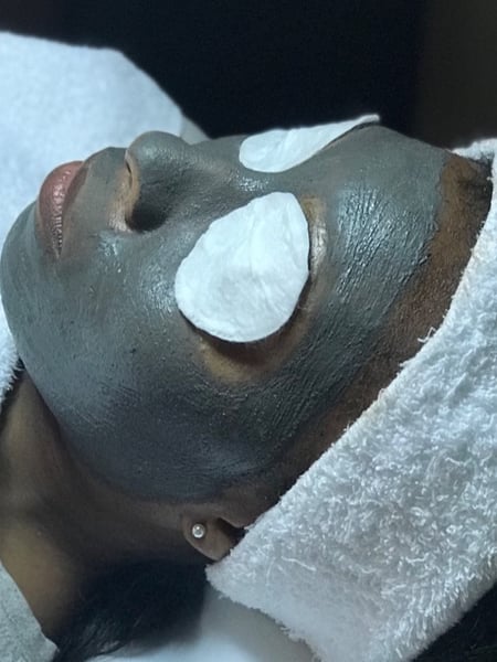 Image of  Cosmetic, Skin Treatments, Facial, Chemical Peel