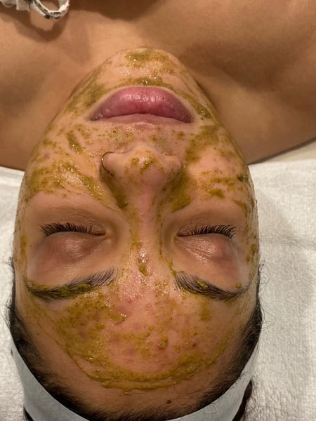 Image of  Facial, Skin Treatments
