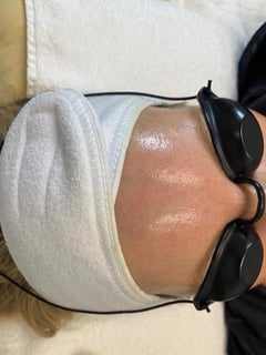 View Legs , Facial, Skin Treatments, Chemical Peel, Microdermabrasion, Waxing, Facial , Underarms , Bikini Area  - Olga , Lighthouse Point, FL