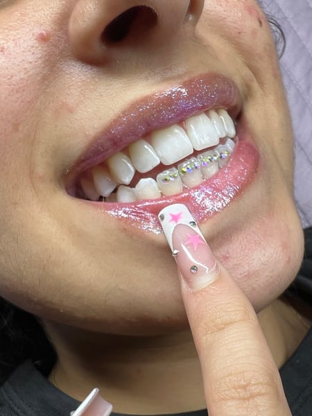Image of  Teeth Whitening, Dentistry, Dental Bonding, Dentistry Services