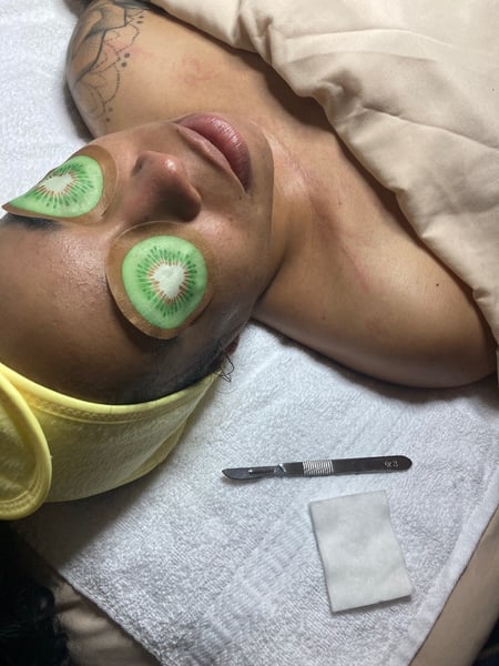 Image of  Facial, Skin Treatments, Dermaplaning