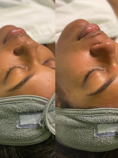 Image of  Cosmetic, Facial, Skin Treatments