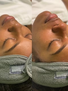 View Cosmetic, Skin Treatments, Facial - Tay Moore, Columbus, GA
