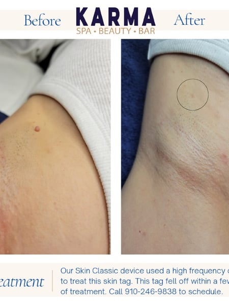 Image of  Skin Treatments, Laser Skin Resurfacing, Skin Treatments