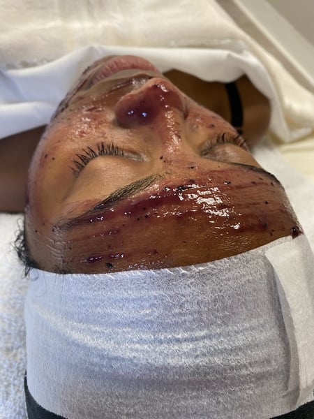 Image of  Facial, Skin Treatments