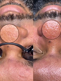 View Skin Treatments, Facial - Takiyah Rockmore, Dallas, TX