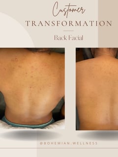 View Cosmetic, Skin Treatments - Tiffany Woodard, Tempe, AZ