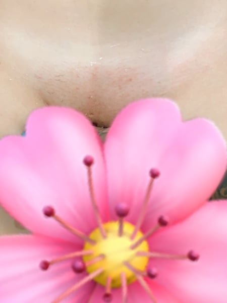 Image of  Cosmetic, Waxing, Skin Treatments, Bikini Area 