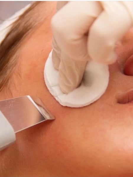 Image of  Cosmetic, Facial, Skin Treatments, Microdermabrasion