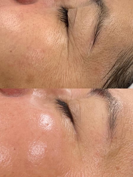 Image of  Cosmetic, Facial, Skin Treatments
