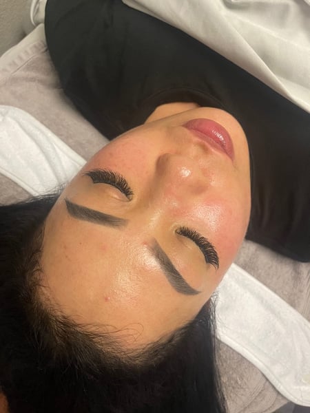 Image of  Skin Treatments, Facial, Chemical Peel, Microdermabrasion, Microneedling, LED Acne Therapy, Dermaplaning, HydraFacial, Skin Treatments