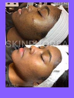 View Cosmetic, Skin Treatments, Facial, Microdermabrasion, Waxing, Chemical Peel - Brielle Hicks, Detroit, MI