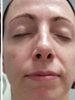 View Skin Treatments, Facial, Cosmetic - Jenna Duncan, Atlanta, GA