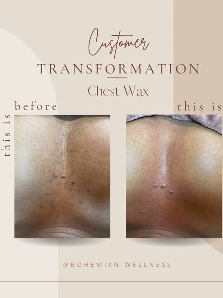 Image of  Cosmetic, Waxing, Skin Treatments
