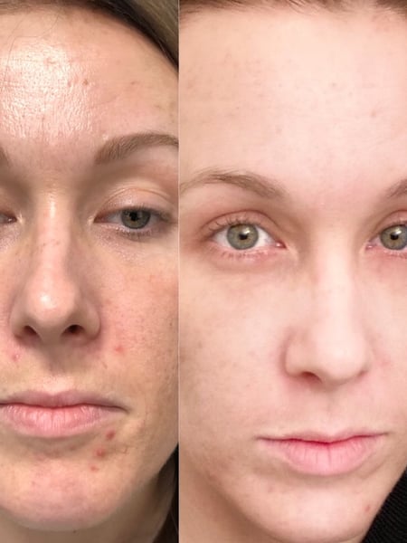 Image of  Cosmetic, Minimally Invasive, Skin Treatments