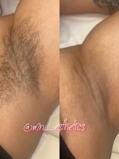 View Waxing, Cosmetic, Underarms  - Michelle Neff, Columbus, OH