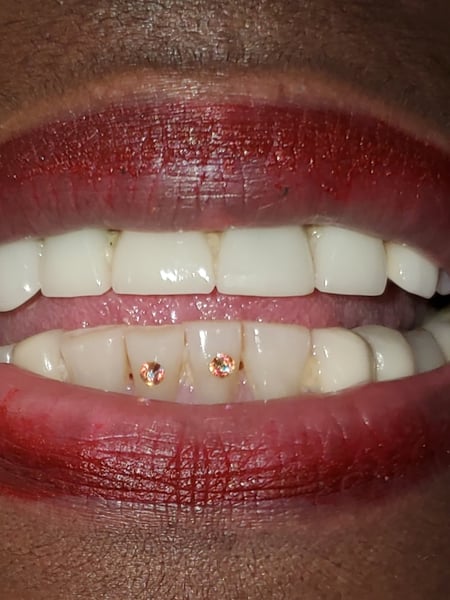 Image of  Cosmetic, Cosmetic Tattoos, Teeth Whitening, Lip Blush , Dentistry, Teeth Bleaching
