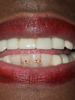 View Lip Blush , Cosmetic, Cosmetic Tattoos, Teeth Whitening, Dentistry, Teeth Bleaching - Mila , San Jose, CA