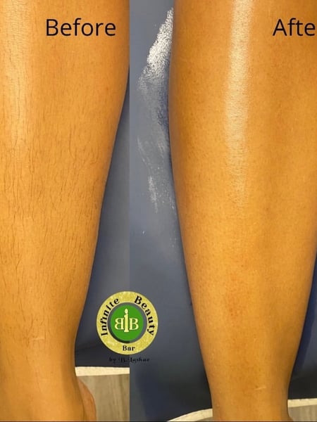 Image of  Cosmetic, Legs , Waxing