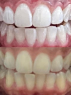 View Teeth Whitening, Dentistry, Teeth Bleaching, Dentistry Services - Carolina Guillermo, New York, NY