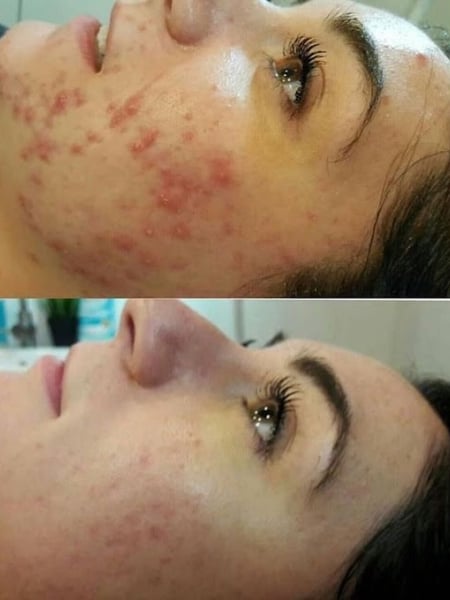 Image of  Cosmetic, Skin Treatments, Facial