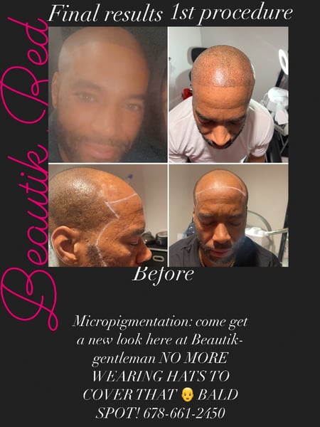 Image of  Scalp Micropigmentation, Cosmetic Tattoos, Cosmetic