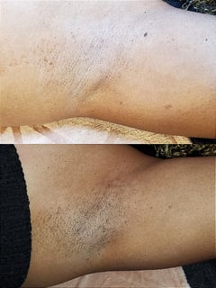 View Skin Treatments, Underarms , Waxing - Jasmine Hampton, Girard, OH