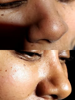 View Facial, Skin Treatments - Jasmine Hampton, Girard, OH