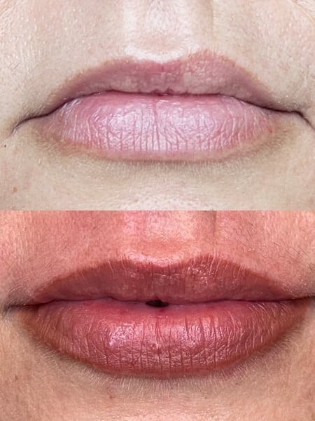 Image of  Cosmetic, Lips, Filler, Lip Blush , Cosmetic Tattoos