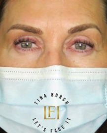 Image of  Brows, Arched, Brow Shaping, Nano-Stroke, Microblading