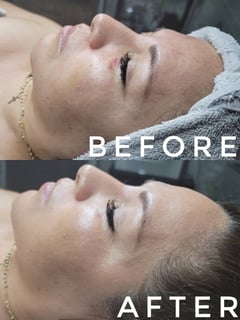 View Facial, Skin Treatments - Brittany Mason, Fort Worth, TX