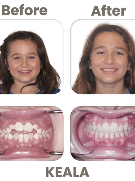Image of  Dentistry, Dental Braces, Dentistry Services