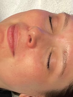 View Facial, Skin Treatments - Altie Thomas, Frisco, TX