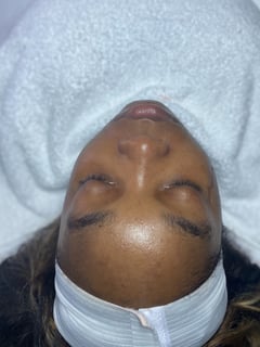 View Facial, Skin Treatments - Jennifer Wright, Dallas, TX